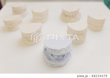 Dental casting gypsum model of human jaws. Crooked teeth and distal bite. Shots were made before treatment with braces . Technical shots on gray background. Dental casting gypsum model of human jaws. Crooked teeth and distal bite. Shots were made before treatment with braces . Technical shots on gray background. 68234479
