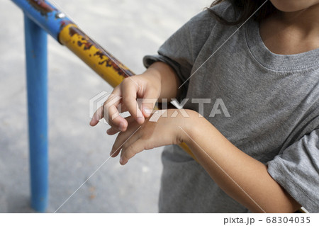 絆創膏を貼る子供 絆創膏を貼る子供 68304035