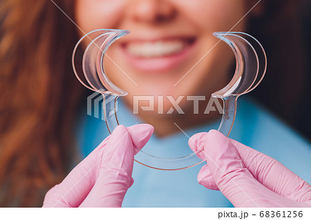 Close-up portrait of a female patient visiting dentist for teeth whitening in clinic,Teeth whitening procedure. Close-up portrait of a female patient visiting dentist for teeth whitening in clinic,Teeth whitening procedure. 68361256