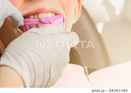 Registration of impressions and bites in a young teenager. Functional modern dental diagnostics. 68361484