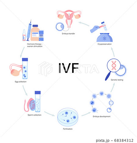 IVF vector illustration IVF vector illustration 68384312