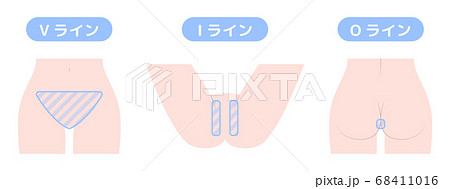 脱毛箇所　VIO　デリケートゾーン 68411016