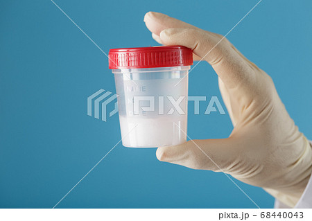 Semen in a jar for analysis in the doctor's hand 68440043