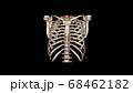 Computed Tomography Volume Rendering examination of the  thoracic cage ( CT VR thoracic cage). 3D rendering 68462182