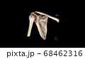 Computed Tomography Volume Rendering examination of the  Shoulder ( CT VR shoulder). 3D rendering 68462316