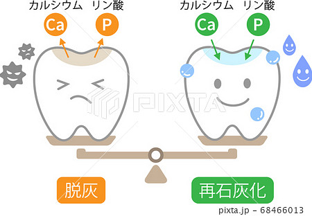 歯 脱灰と再石灰化のイラスト素材