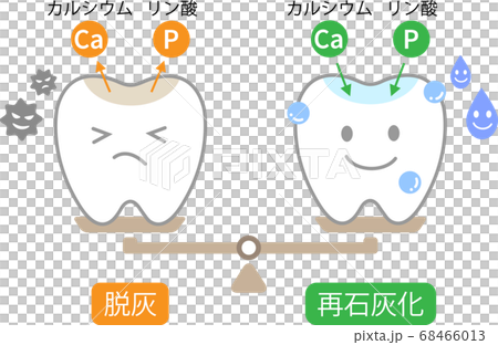 歯 脱灰と再石灰化のイラスト素材