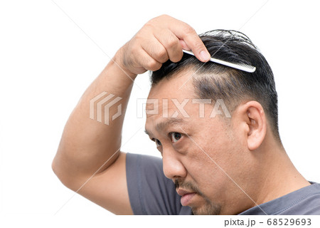 Middle-aged asian man worry about his hair loss Middle-aged asian man worry about his hair loss 68529693