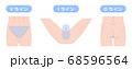 脱毛箇所　VIO　デリケートゾーン 68596564