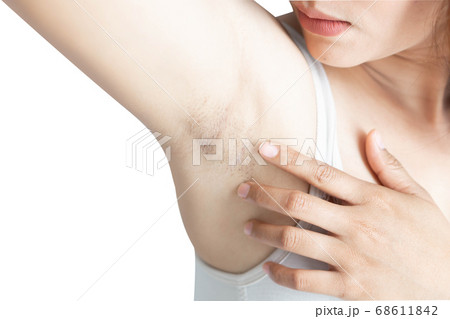 Women problem black armpit on white background for Women problem black armpit on white background for 68611842