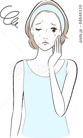 ニキビ肌で悩む女性 ニキビ肌で悩む女性 68646330