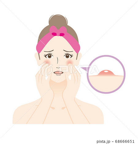 ニキビに悩む女性のイラストのイラスト素材
