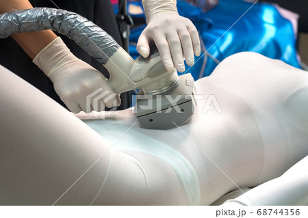 LPG massage for lifting body. Cosmetology procedure in the salon. Anti-cellulite body treatment LPG massage for lifting body. Cosmetology procedure in the salon. Anti-cellulite body treatment 68744356