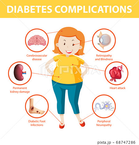 Modeling long-term diabetes and related complications in rats