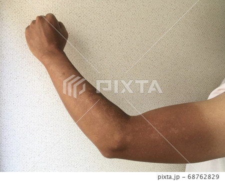 Tシャツ焼けしている男性の腕 68762829