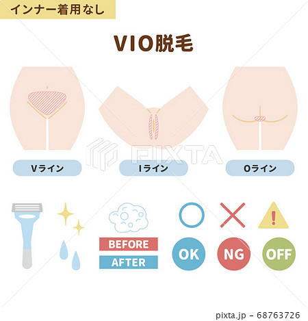 Vio脱毛箇所のイラストセット インナー着用なし のイラスト素材