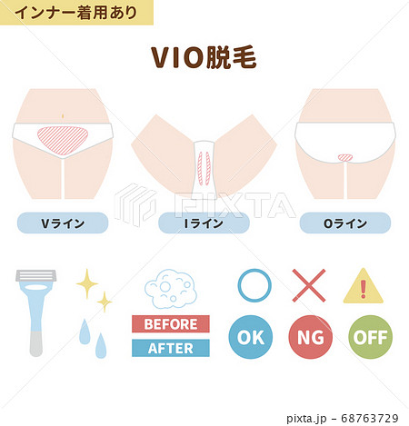 VIO脱毛箇所のイラストセット(インナー着用あり) VIO脱毛箇所のイラストセット(インナー着用あり) 68763729