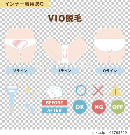 VIO脱毛箇所のイラストセット(インナー着用あり) VIO脱毛箇所のイラストセット(インナー着用あり) 68763729