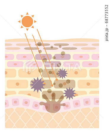 肌の構造/皮膚の構造_紫外線 肌の構造/皮膚の構造_紫外線 68773552