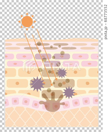 肌の構造/皮膚の構造_紫外線 肌の構造/皮膚の構造_紫外線 68773552