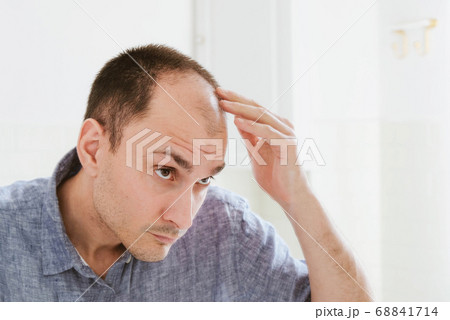 Young man looking at mirror worry about balding. Young man looking at mirror worry about balding. 68841714