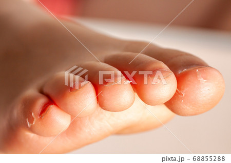 The girl's right foot cloth up bwtween the toes 68855288