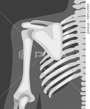X-ray Film of Chest Vector Illustrated Image for Educational Purpose X-ray Film of Chest Vector Illustrated Image for Educational Purpose 68912900