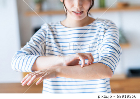 肌がかゆい若い女性　 68919556