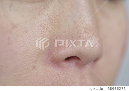 女性の鼻まわり 毛あな 68936275