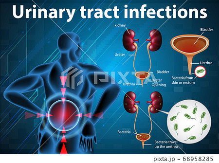 Informative illustration of urinary tract Informative illustration of urinary tract 68958285