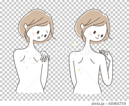 背中トラブル ビフォーアフター 背中トラブル ビフォーアフター 68968759