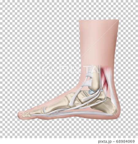 Plantar fascia and Achilles tendon 68984069