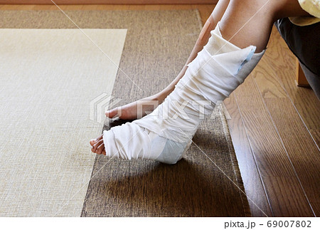 怪我をした足 ギブスをした足 骨折捻挫した足 イメージ素材の写真素材