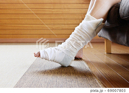 怪我をした足　ギブスをした足　骨折捻挫した足　イメージ素材 69007803