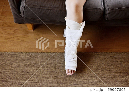怪我をした足　ギブスをした足　骨折捻挫した足　イメージ素材 69007805
