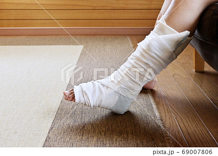 怪我をした足　ギブスをした足　骨折捻挫した足　イメージ素材 69007806