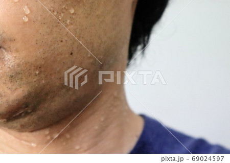 トレーニング後の男性の汗のクローズアップ 69024597