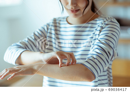 アレルギーの若い女性 69036417