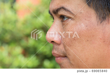 Face skin of asian man to show many skin problem. Men skin care 69065840