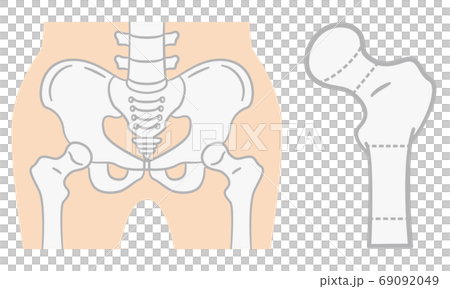 股骨近端分類 69092049