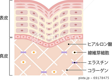 しわ　肌の断面図 69178475