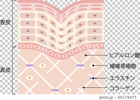 しわ　肌の断面図 69178475