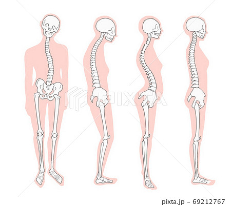悪い姿勢のパターン　骨格とシルエット 69212767
