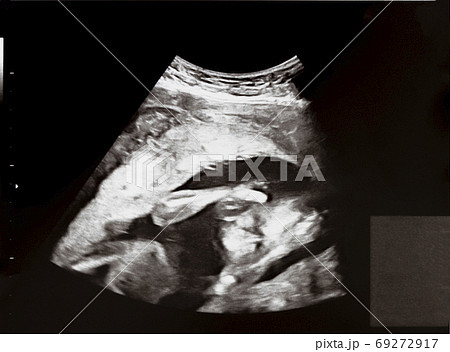 妊娠して週目の胎児のエコー写真の写真素材