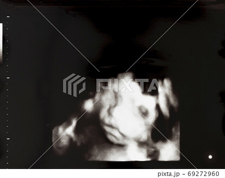 妊娠して25週目の胎児のエコー写真の写真素材