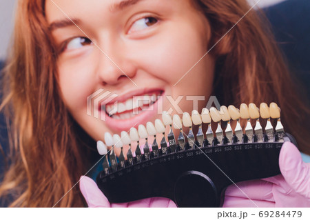 The dentist comparing patient's teeth shade with samples for bleaching treatment. 69284479