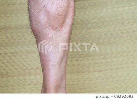 筋トレで筋肉が付いた男性のふくらはぎ　右足 69292092