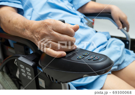 Asian senior or elderly old lady woman patient show her scars su 69300068