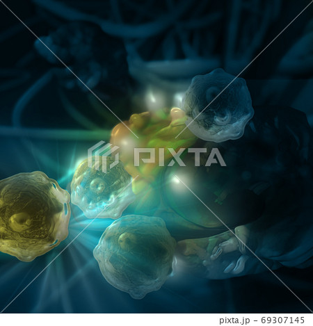 Digital 3d illustration of cancer cells in human body. 69307145