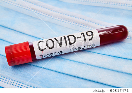 Conceptual photo. Blood test sample for presence 69317471